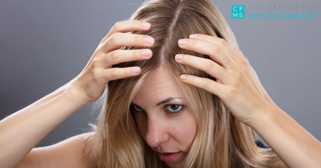 a woman (model) combs through her hair looking for pilar cysts